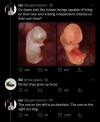 fetuses.png